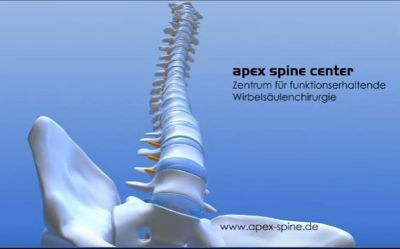 apex spine wirbelsaeule - Komplexe Bandscheiben Operationen verlangen ausgewiesene Spezialisten